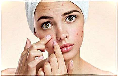 natural soaps are effective against acne