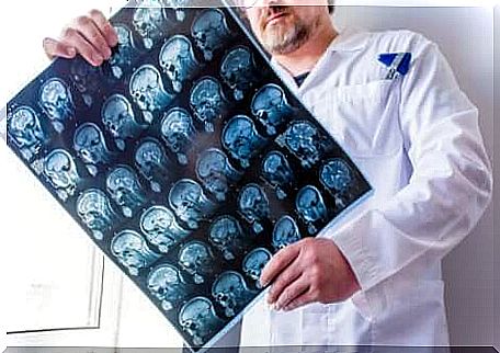 A doctor who examines x-rays of the head. 