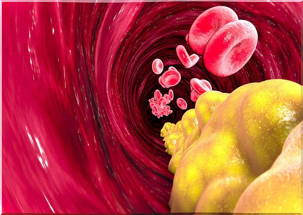 arterial pressure