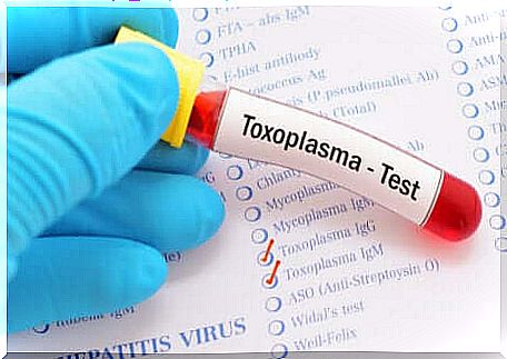 The serological test can diagnose ocular toxoplasmosis.