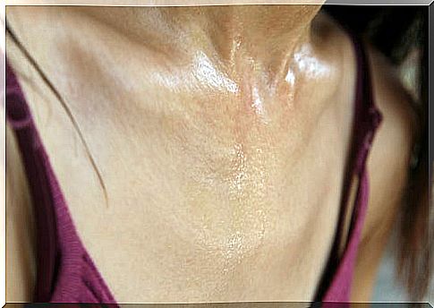 excessive sweating while sleeping