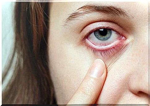 Causes of ophthalmic migraines