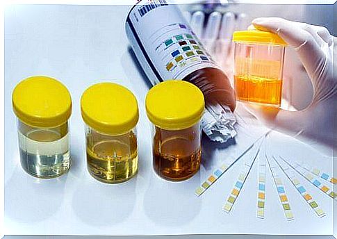 Tests for nitrites in urine