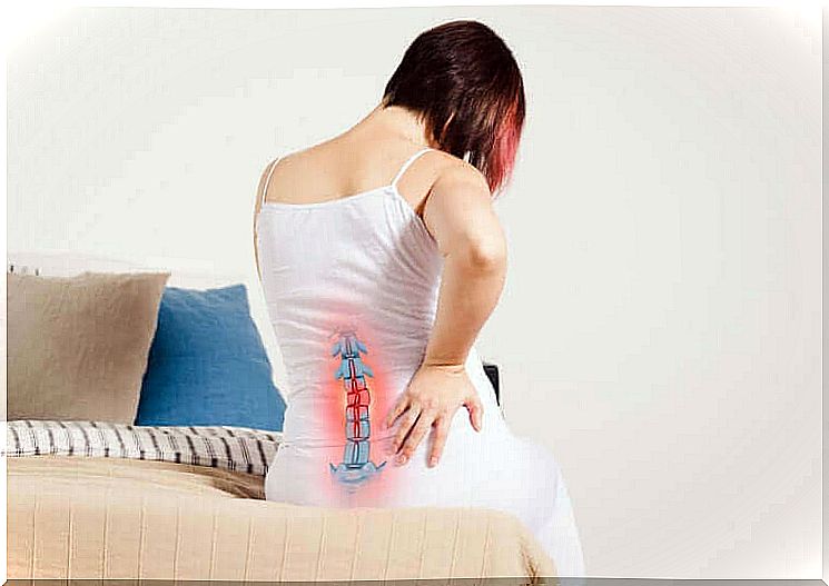 A woman suffering from radiculopathy