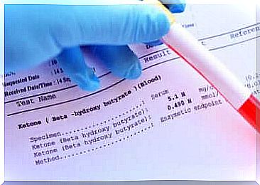 A blood test for hyperkalemia.