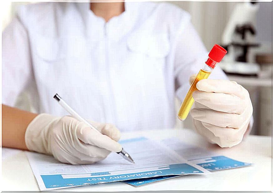 A doctor who does a urinalysis to check for low urine creatinine