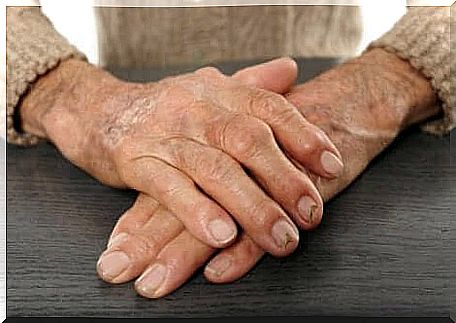 Rheumatoid arthritis.