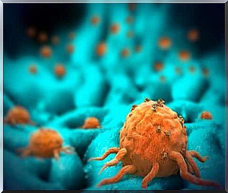 Tumor cells. 